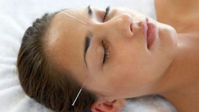 Akupunktur ile Migren Tedavisi
