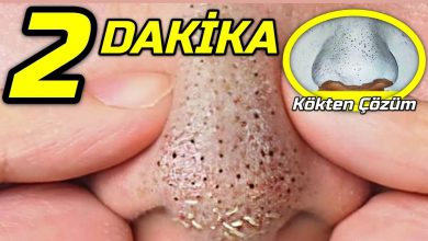 Aras Barlas 2 Dakikada Cildi Yüzü Porselen Gibi Yapan Gözenek Kapatıcı Maske 2026 Cosmelan Aras Barlas 2 Dakikada Cildi Yüzü Porselen Gibi Yapan Gözenek Kapatıcı Maske