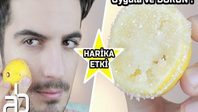 Aras Barlas Yarım Limonu Şekere Batırın ve Cildiniz Kusursuz Olsun 2026 Güneş lekeleri Aras Barlas Yarım Limonu Şekere Batırın ve Cildiniz Kusursuz Olsun