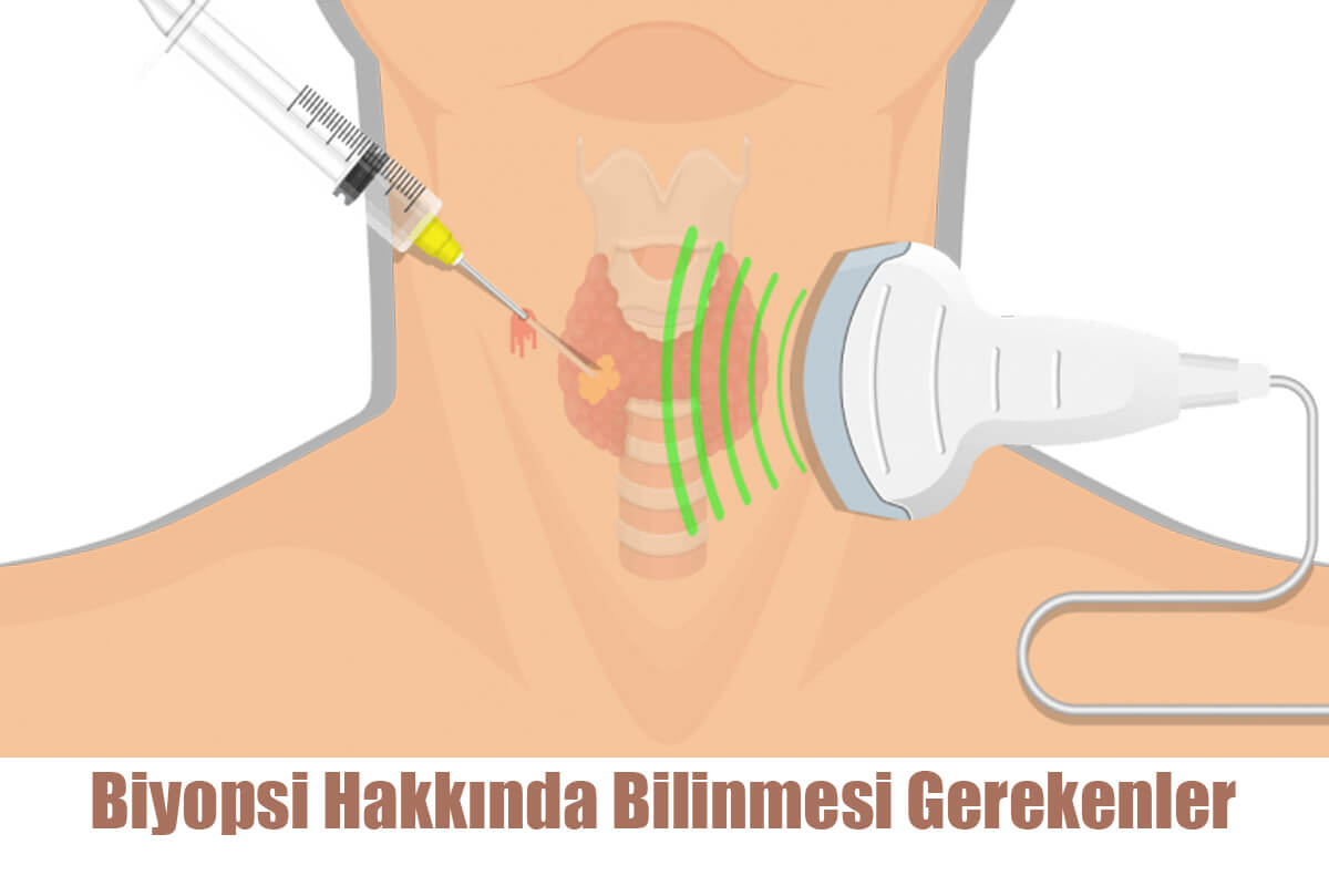 Biyopsi Hakkında Bilinmesi Gerekenler