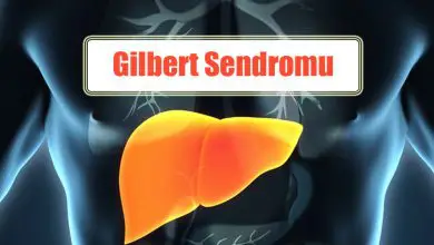 Gilbert Sendromu Nedir? Oluşumu, Semptomları ve Tedavisi