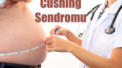 Cushing Sendromu Nedir? Belirtileri ve Tedavisi