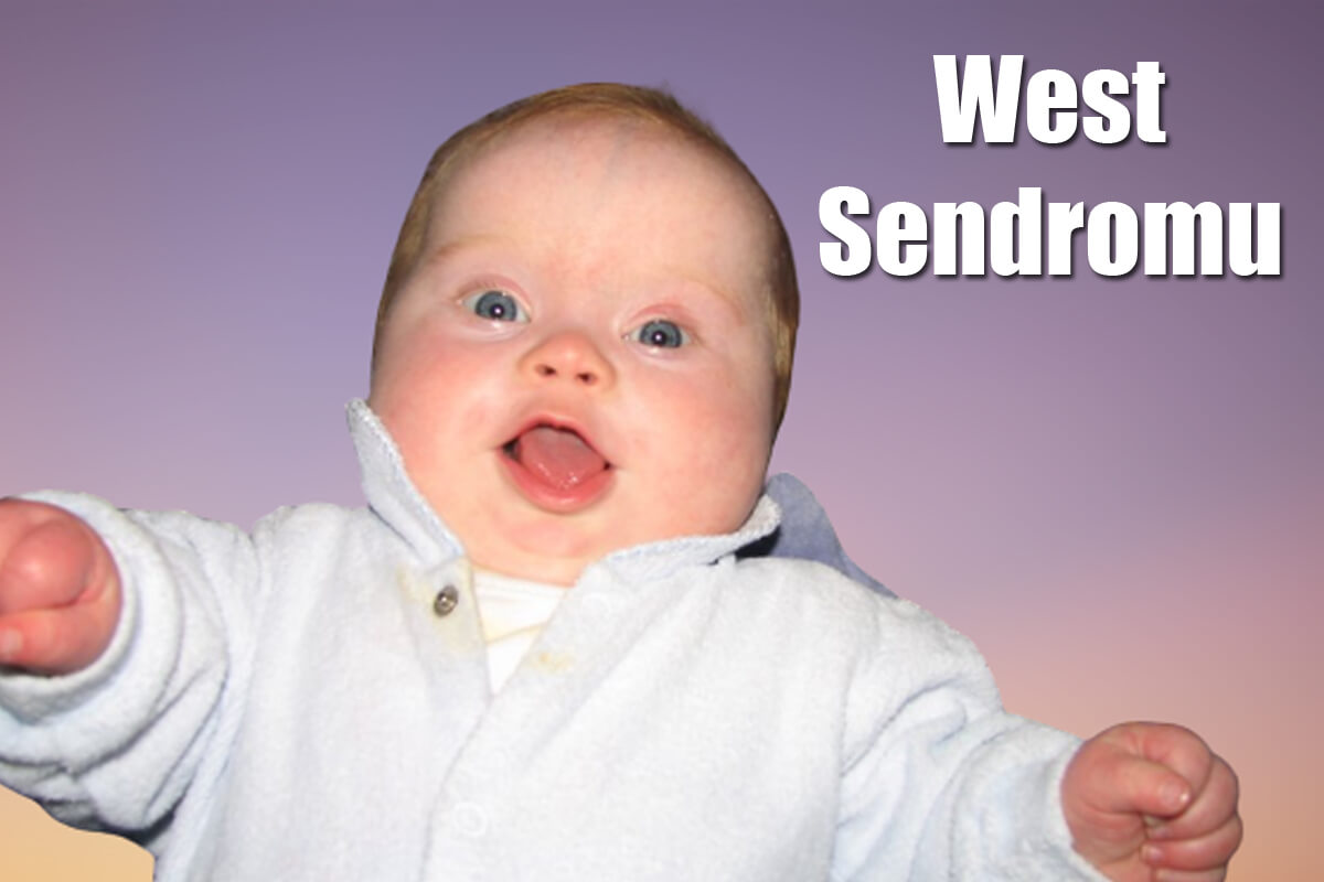 West Sendromu Nedir? Semptomları ve Tedavisi Nedir?