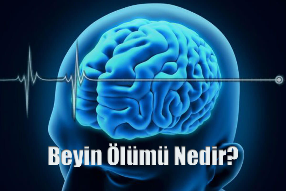 Beyin Ölümü Nedir? Belirtileri Nelerdir?