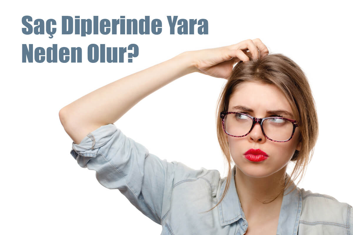 Saç Diplerinde Yara Neden Olur?