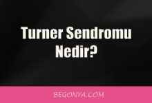 Turner Sendromu Nedir? Tedavisi Nedir?