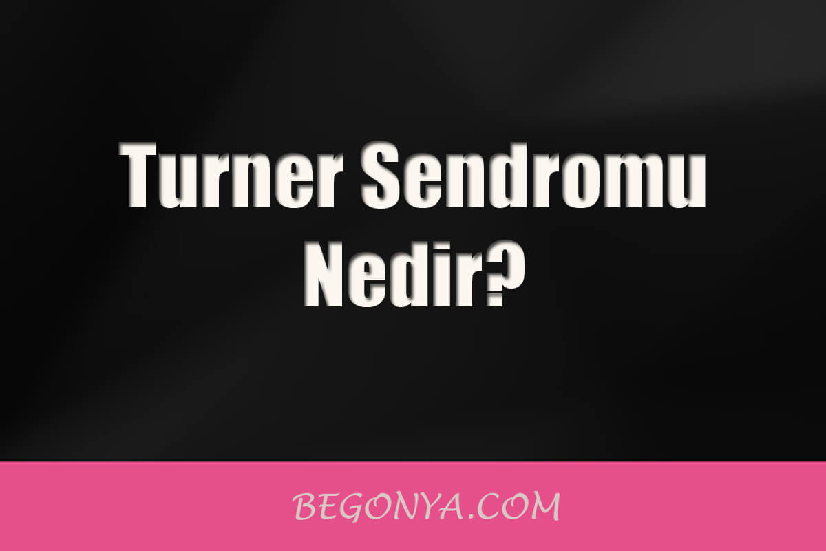 Turner Sendromu Nedir? Tedavisi Nedir? 2025 Turner Sendromu Turner Sendromu Nedir? Tedavisi Nedir?