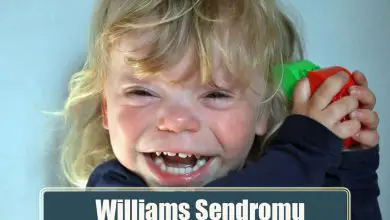 Williams Sendromu Nedir? Williams Sendromu Belirtileri ve Tedavisi