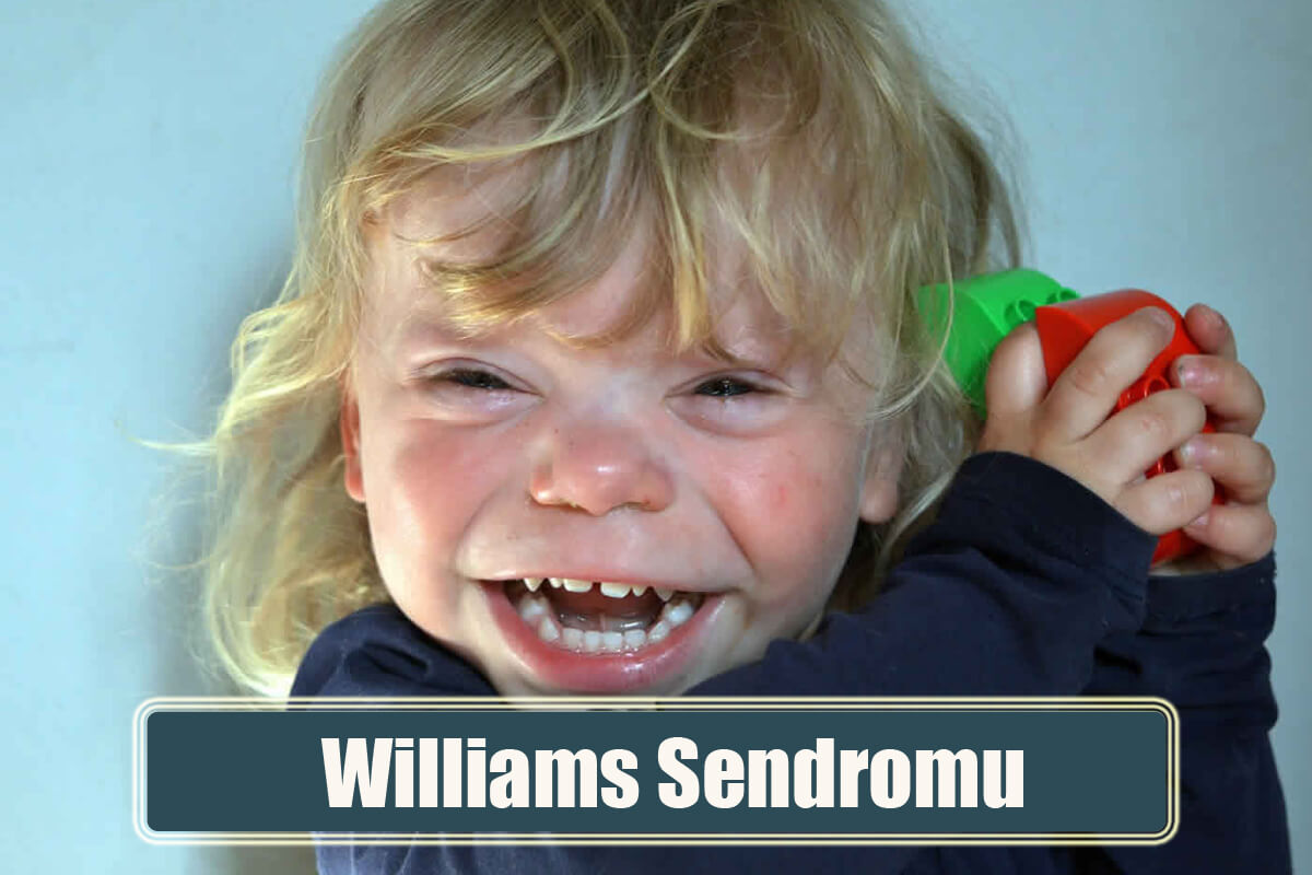 Williams Sendromu Nedir? Williams Sendromu Belirtileri ve Tedavisi