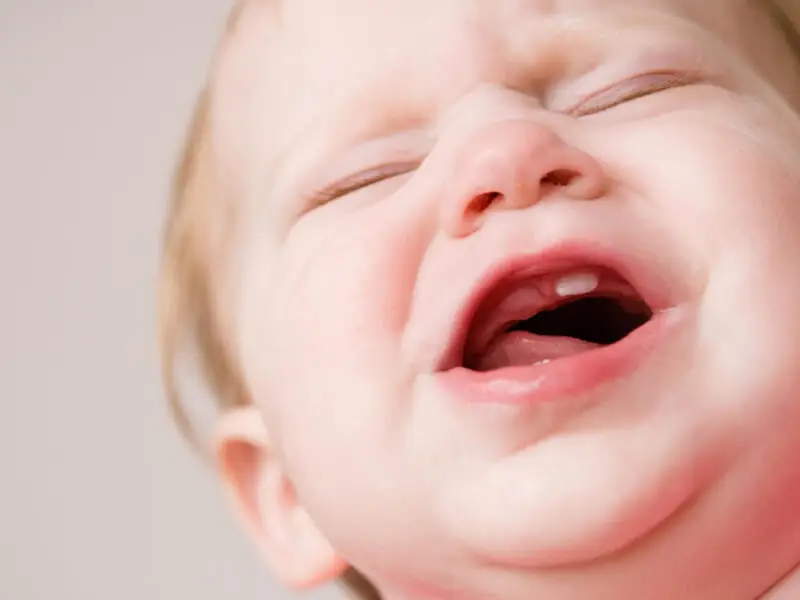 Bebeklerde Diş Çıkması Neden Gecikir?