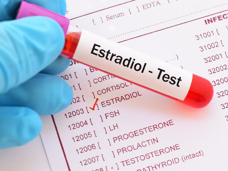 Estradiol Testi Nedir?
