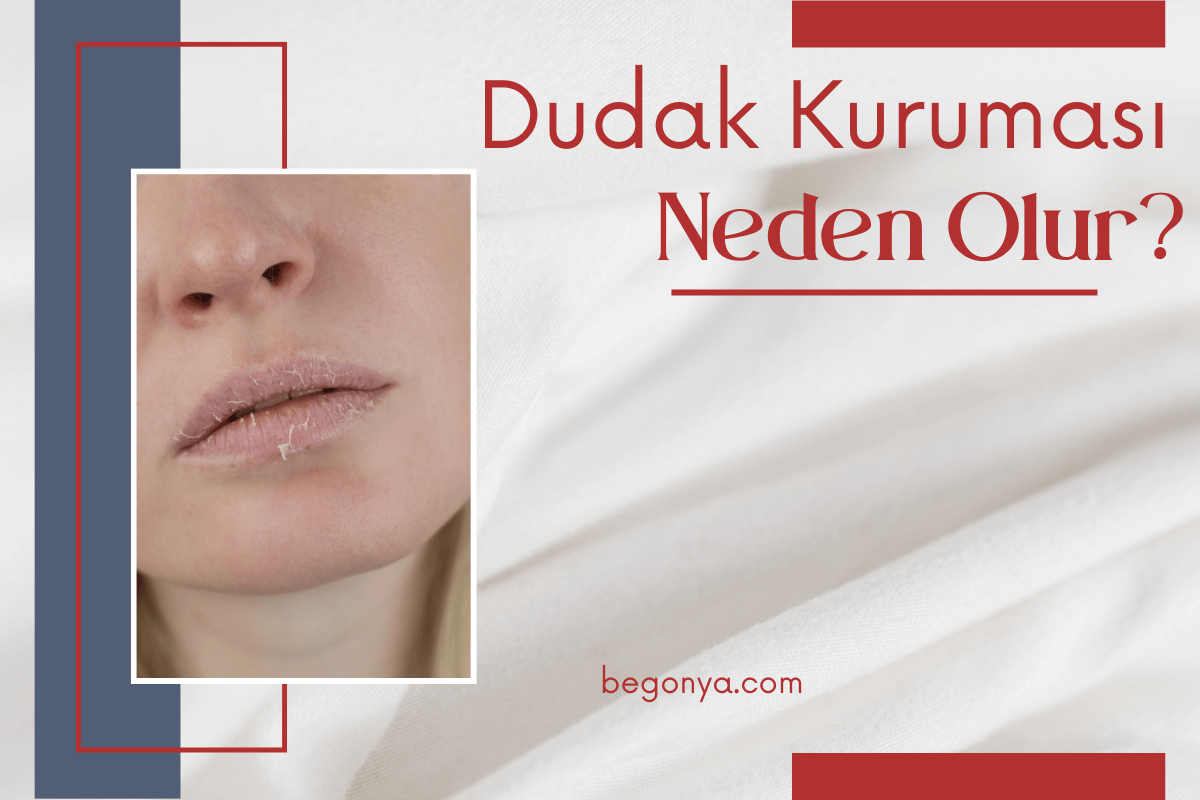 Dudak Kuruması Neden Olur?