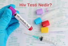 Hiv Testi Nedir?