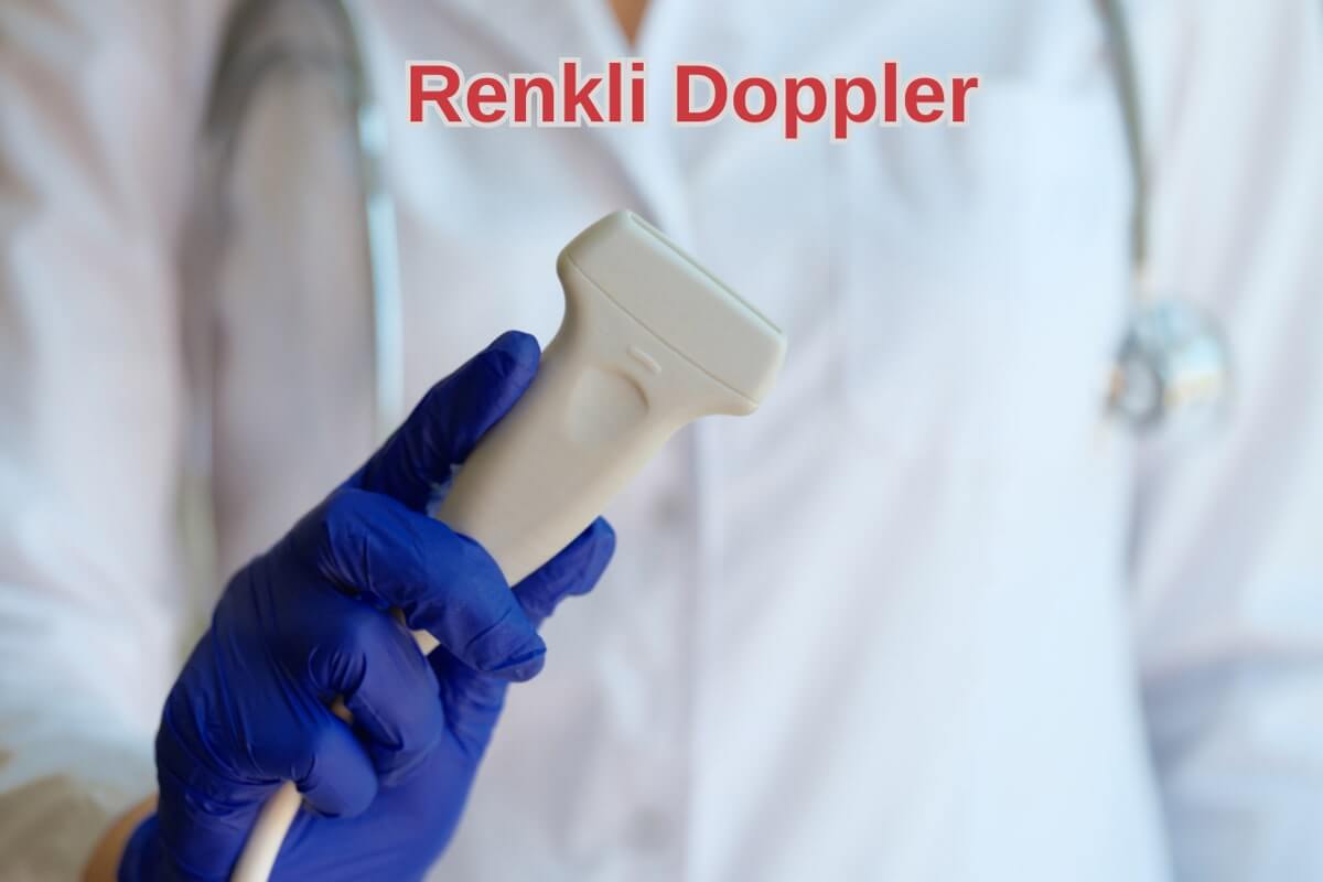 Renkli Doppler