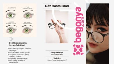 Göz Hastalıkları