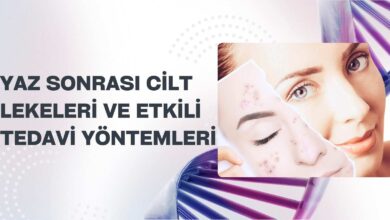 Yaz Sonrası Cilt Lekeleri ve Etkili Tedavi Yöntemleri 2026 Muskat Yaz Sonrası Cilt Lekeleri ve Etkili Tedavi Yöntemleri