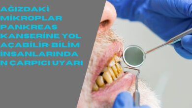 Ağızdaki Mikroplar Pankreas Kanserine Yol Açabilir: Bilim İnsanlarından Çarpıcı Uyarı
