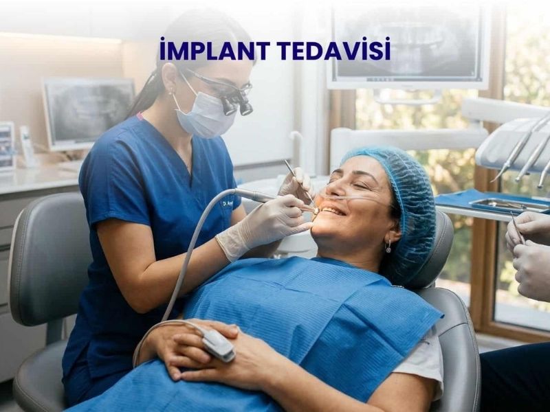 Eksik Dişlerin Modern Çözümü: İmplant Tedavisi ve Merak Edilen "Acı" Faktörü 2026 implant